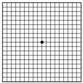 황반변성 자가진단 (암슬러 격자검사)